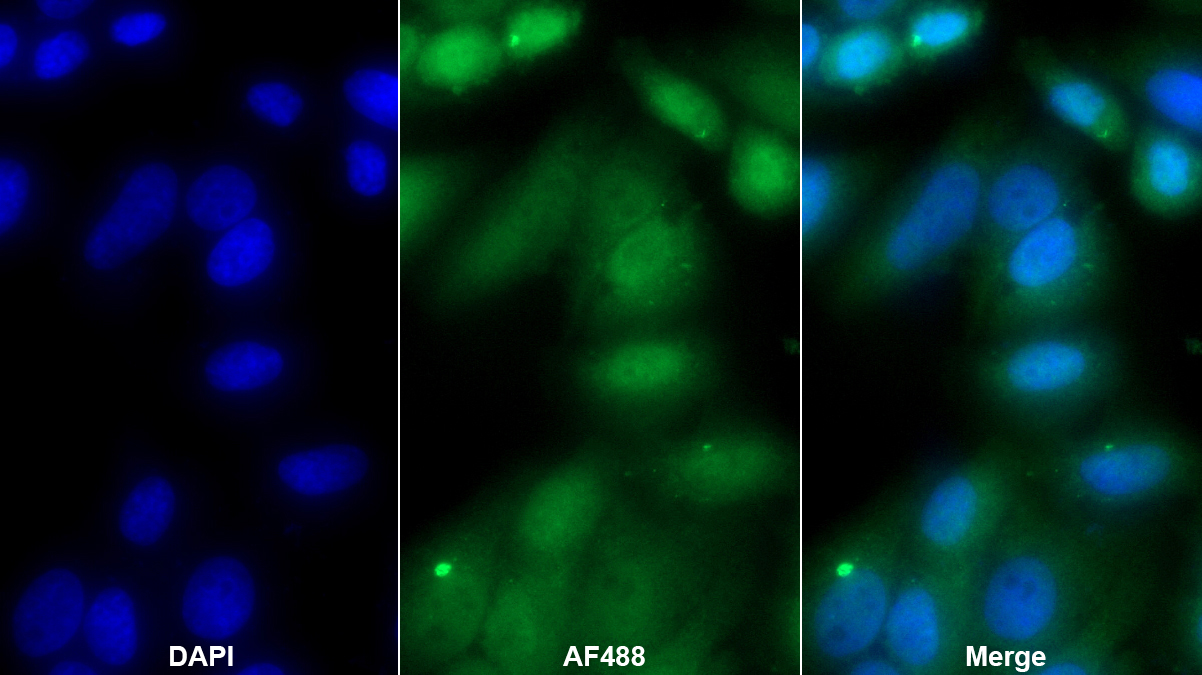 Polyclonal Antibody to Peroxisome Proliferator Activated Receptor Gamma Coactivator 1 Alpha (PPARgC1a)