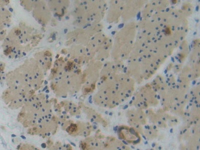 Polyclonal Antibody to Plastin 3 (PLS3)