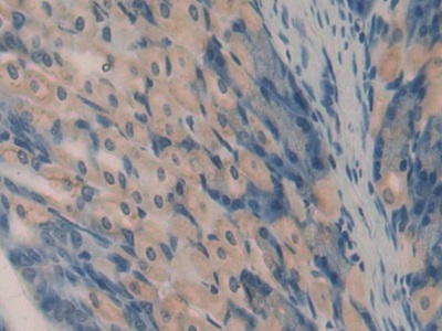 Polyclonal Antibody to Oncomodulin (OCM)