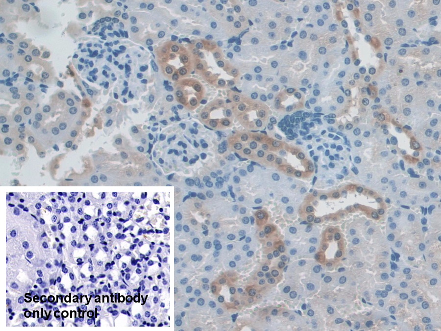 Polyclonal Antibody to Nucleoredoxin (NXN)