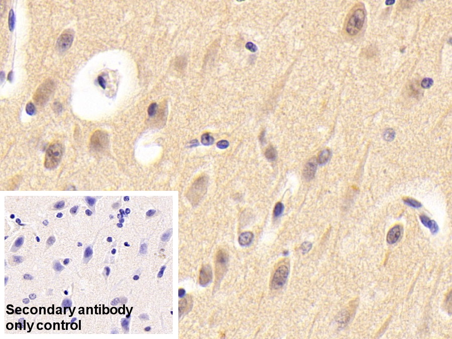 Polyclonal Antibody to Neuritin 1 (NRN1)