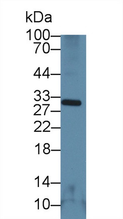 Polyclonal Antibody to Nicotinamide-N-Methyltransferase (NNMT)