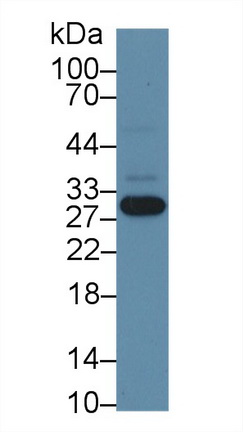Polyclonal Antibody to Nicotinamide-N-Methyltransferase (NNMT)