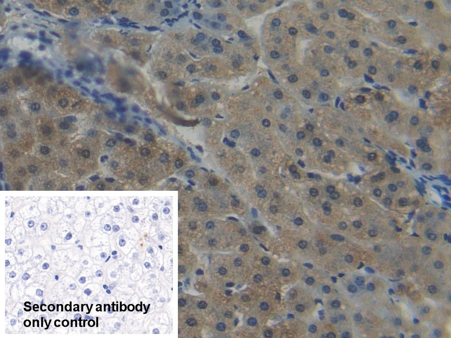 Polyclonal Antibody to Nicotinamide-N-Methyltransferase (NNMT)