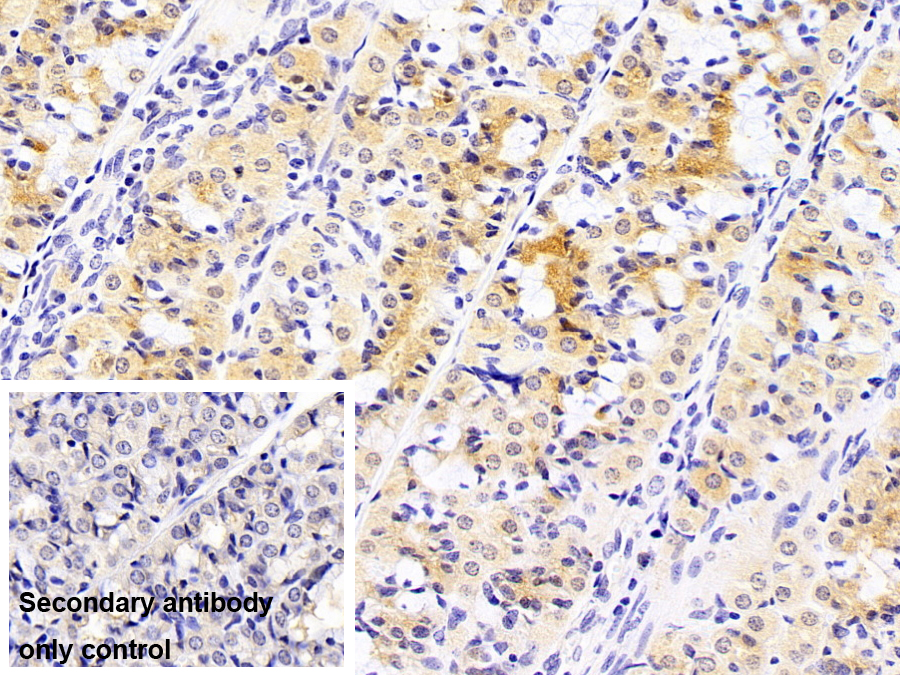 Polyclonal Antibody to NAD Kinase (NADK)
