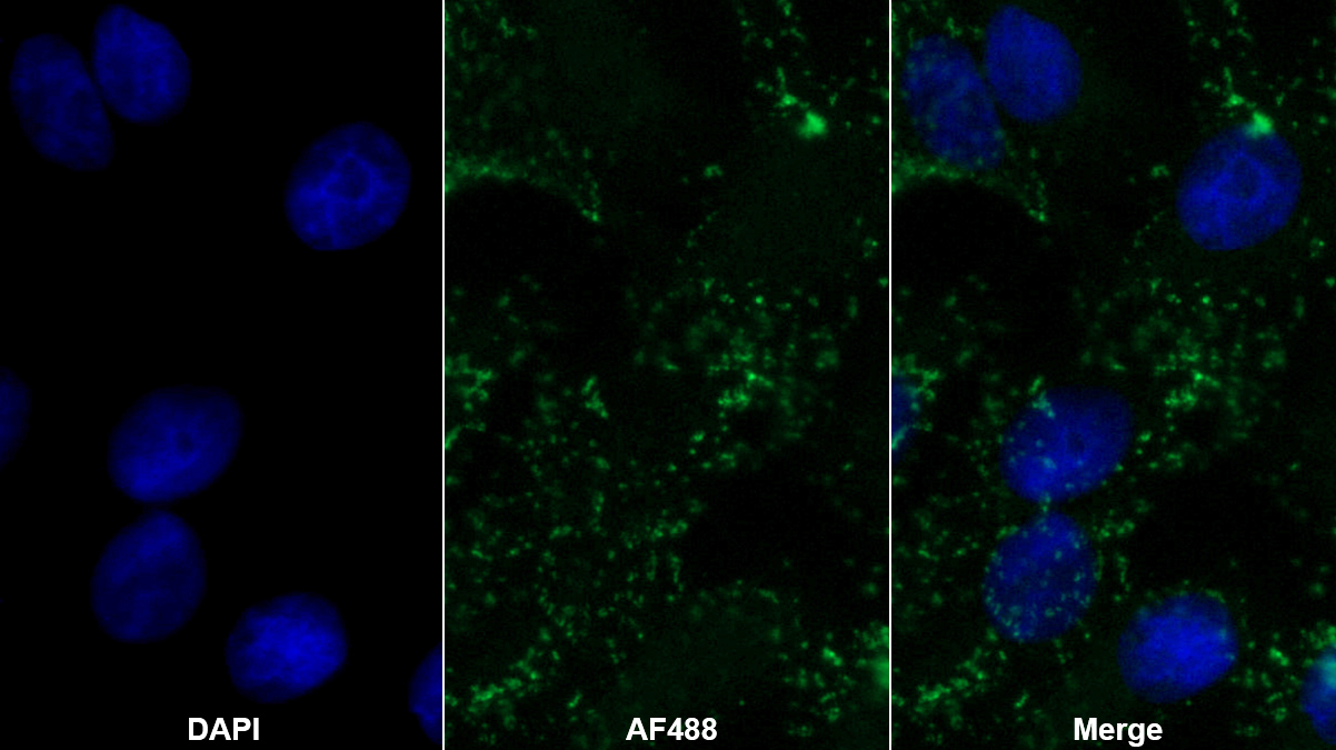Polyclonal Antibody to Mesothelin (MSLN)