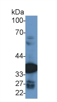 Polyclonal Antibody to Malate Dehydrogenase 2 (MDH2)