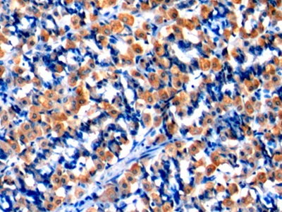 Polyclonal Antibody to Malate Dehydrogenase 2 (MDH2)