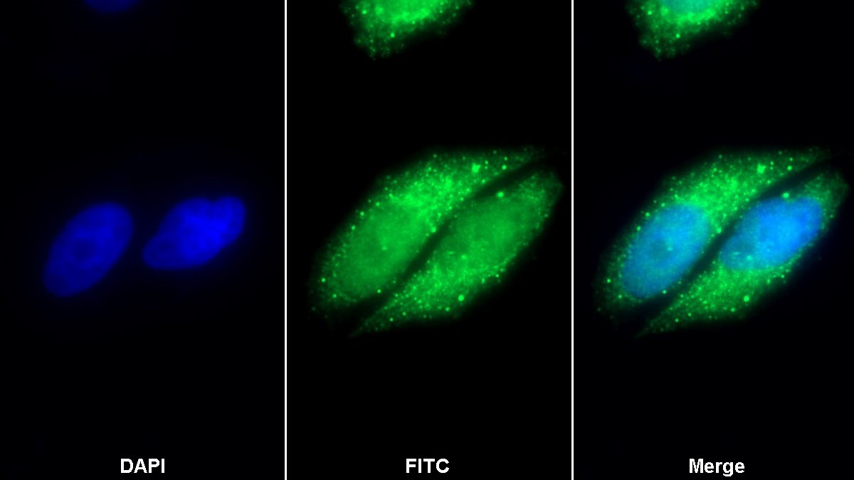 Polyclonal Antibody to Malate Dehydrogenase 2 (MDH2)