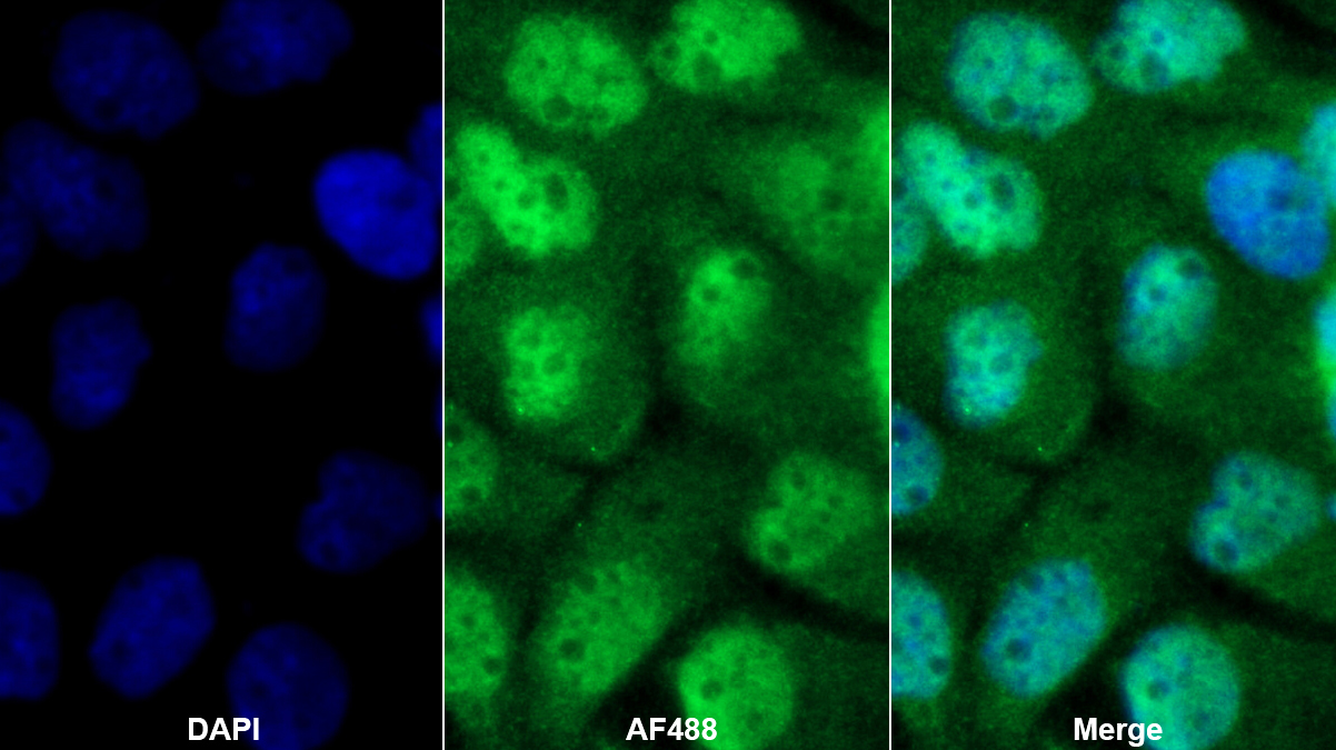 Polyclonal Antibody to MYC Associated Factor X (MAX)