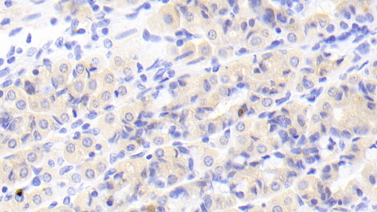 Polyclonal Antibody to Mannosidase Alpha Class 1A Member 1 (MAN1A1)