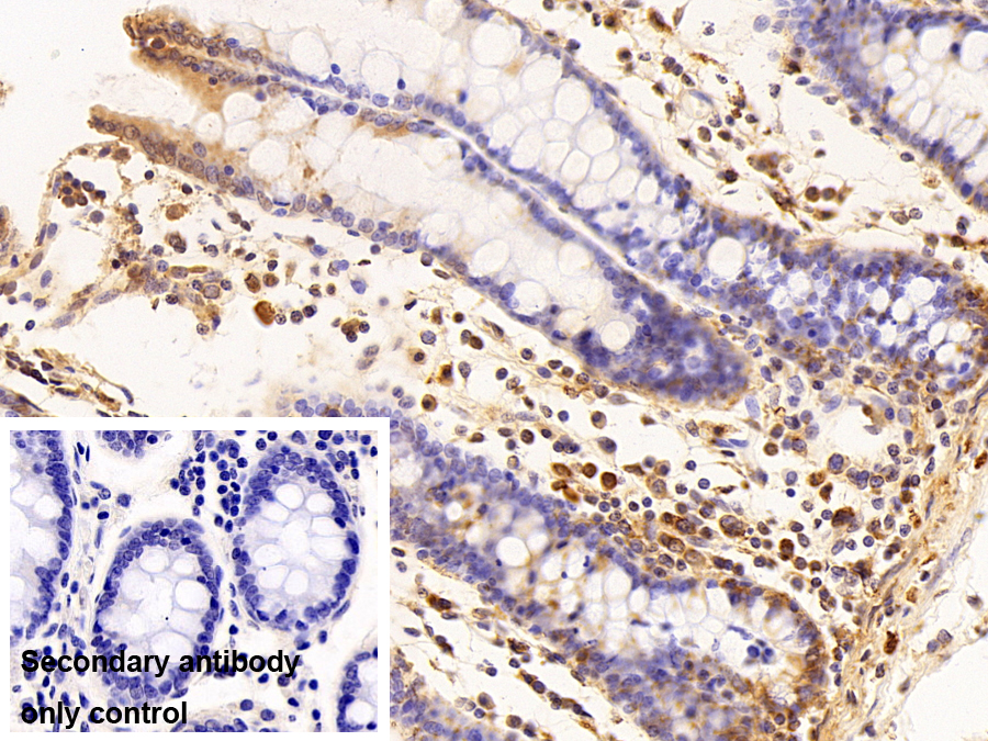 Polyclonal Antibody to Latexin (LXN)