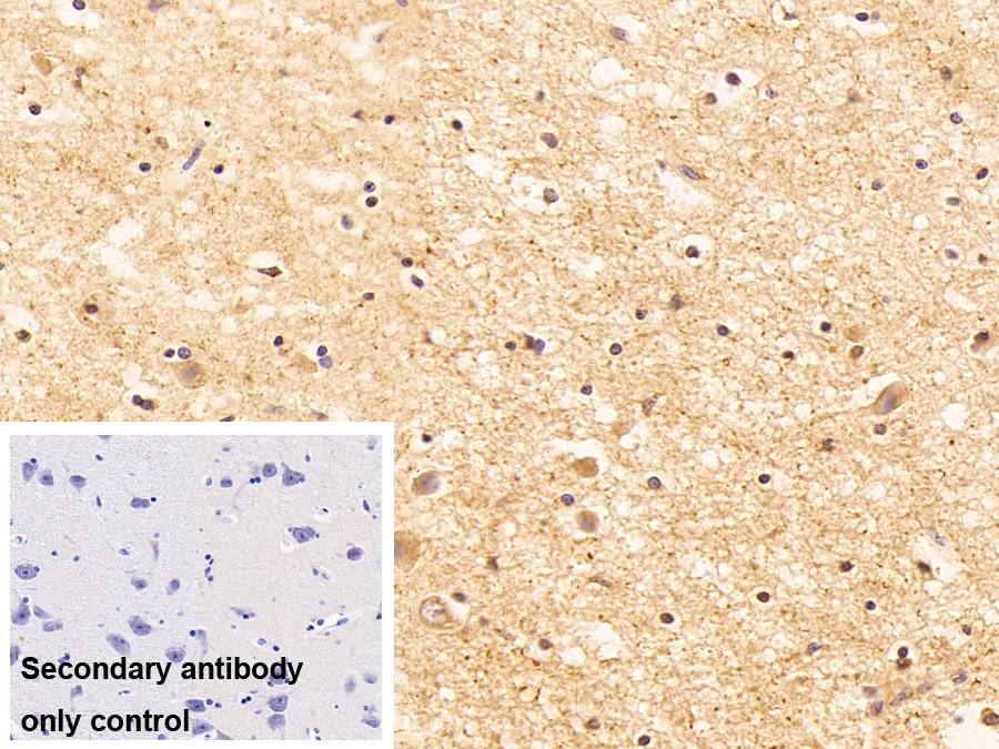 Polyclonal Antibody to Latexin (LXN)