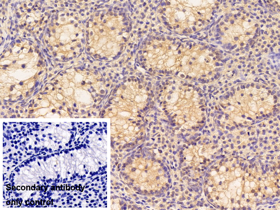 Polyclonal Antibody to Latexin (LXN)