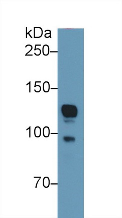 Polyclonal Antibody to Inter Alpha-Globulin Inhibitor H4 (ITIH4)