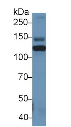 Polyclonal Antibody to Inter Alpha-Globulin Inhibitor H4 (ITIH4)