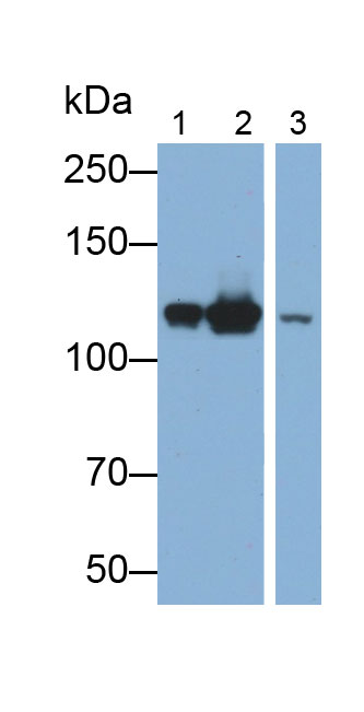 Polyclonal Antibody to Inter Alpha-Globulin Inhibitor H4 (ITIH4)