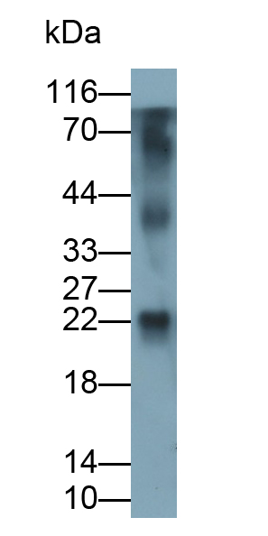 Polyclonal Antibody to Interleukin 1 Receptor Accessory Protein (IL1RAP)