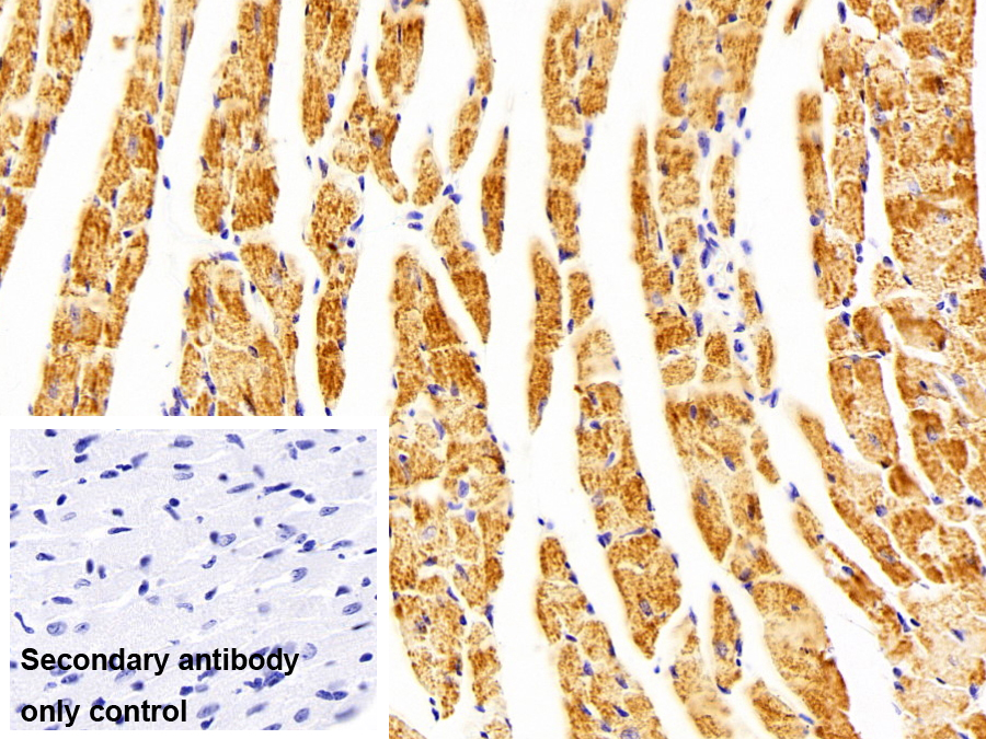 Polyclonal Antibody to Hepatitis B Virus X Interacting Protein (HBXIP)