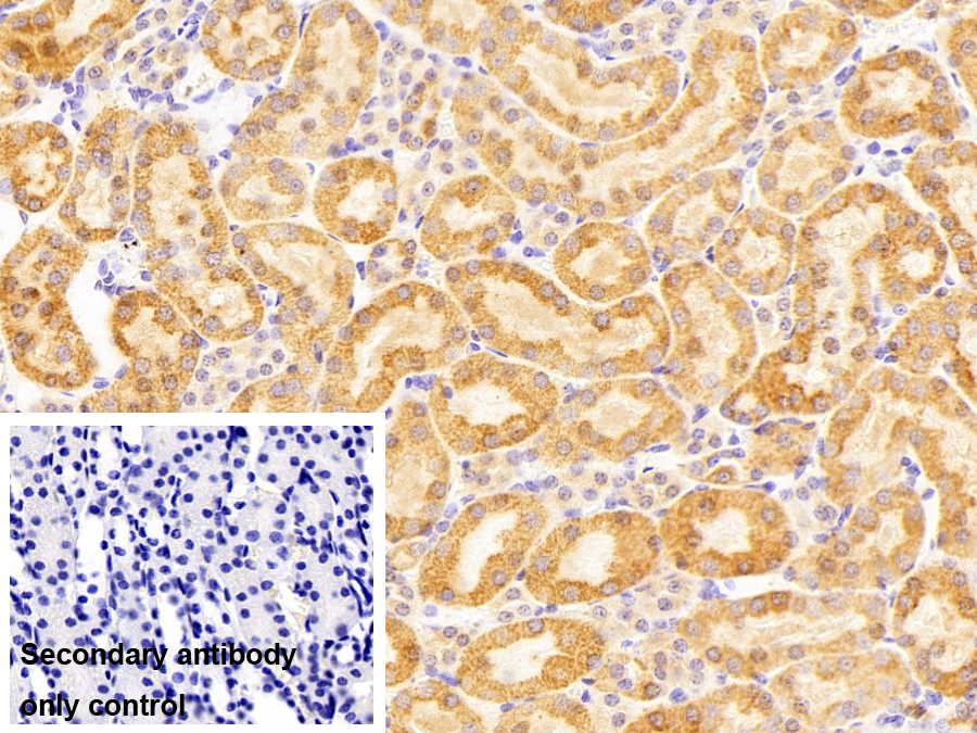 Polyclonal Antibody to Hepatitis B Virus X Interacting Protein (HBXIP)