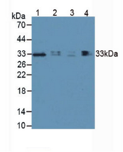 Polyclonal Antibody to Hepatitis A Virus Cellular Receptor 2 (HAVCR2)