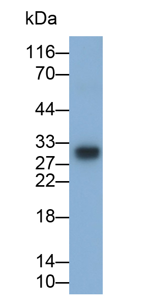 Polyclonal Antibody to Gastrokine 2 (GKN2)
