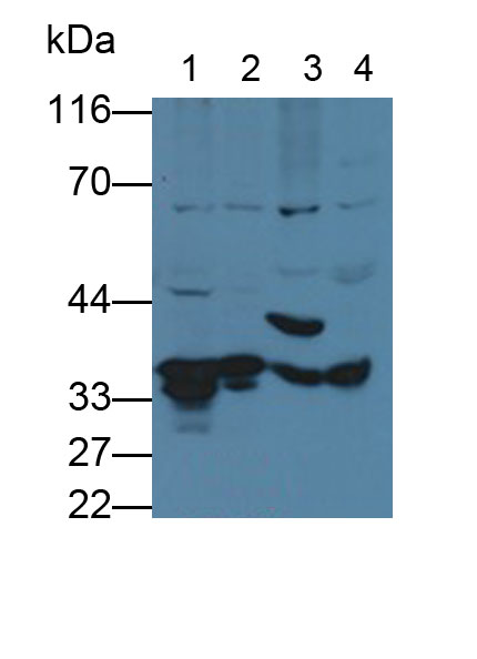 Polyclonal Antibody to Fructosamine-3-Kinase (FN3K)