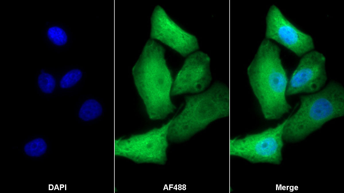 Polyclonal Antibody to Fructosamine-3-Kinase (FN3K)