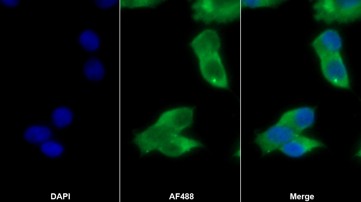 Polyclonal Antibody to Fragile X Mental Retardation 1 (FMR1)