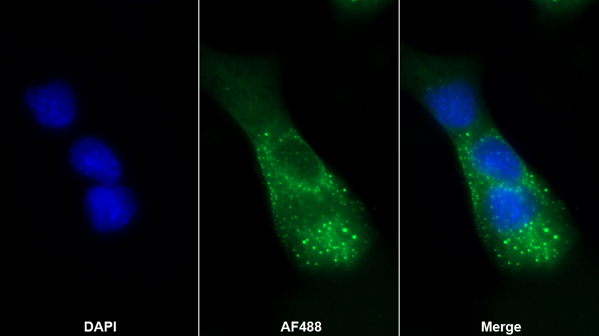 Polyclonal Antibody to Biglycan (BGN)