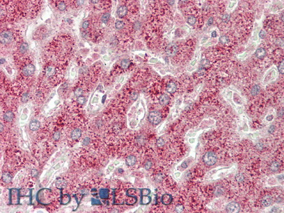 Polyclonal Antibody to DNA Damage Inducible Transcript 3 (DDIT3)