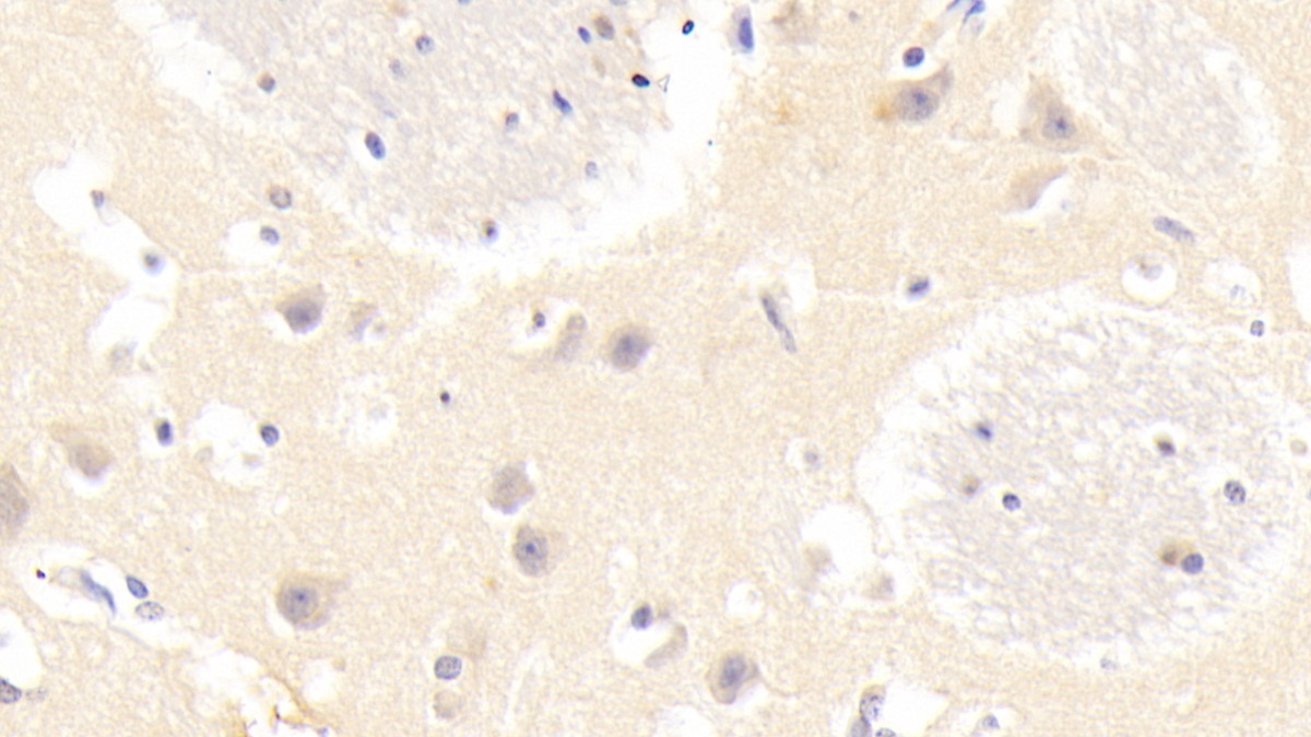 Polyclonal Antibody to GABA-A Receptor Associated Protein Like Protein 2 (GABARAPL2)