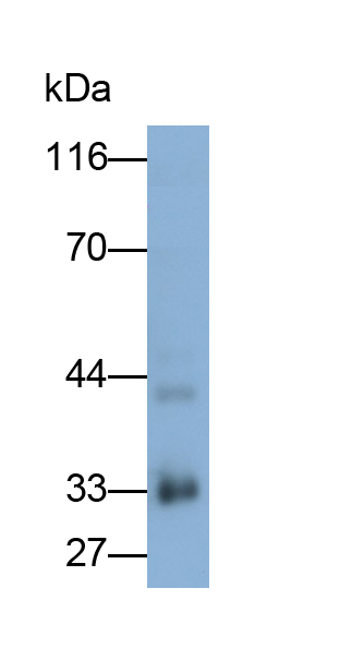 Polyclonal Antibody to Coxsackie Virus And Adenovirus Receptor (CXADR)