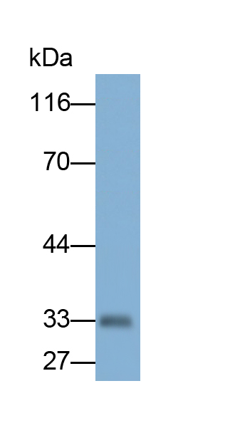 Polyclonal Antibody to Coxsackie Virus And Adenovirus Receptor (CXADR)