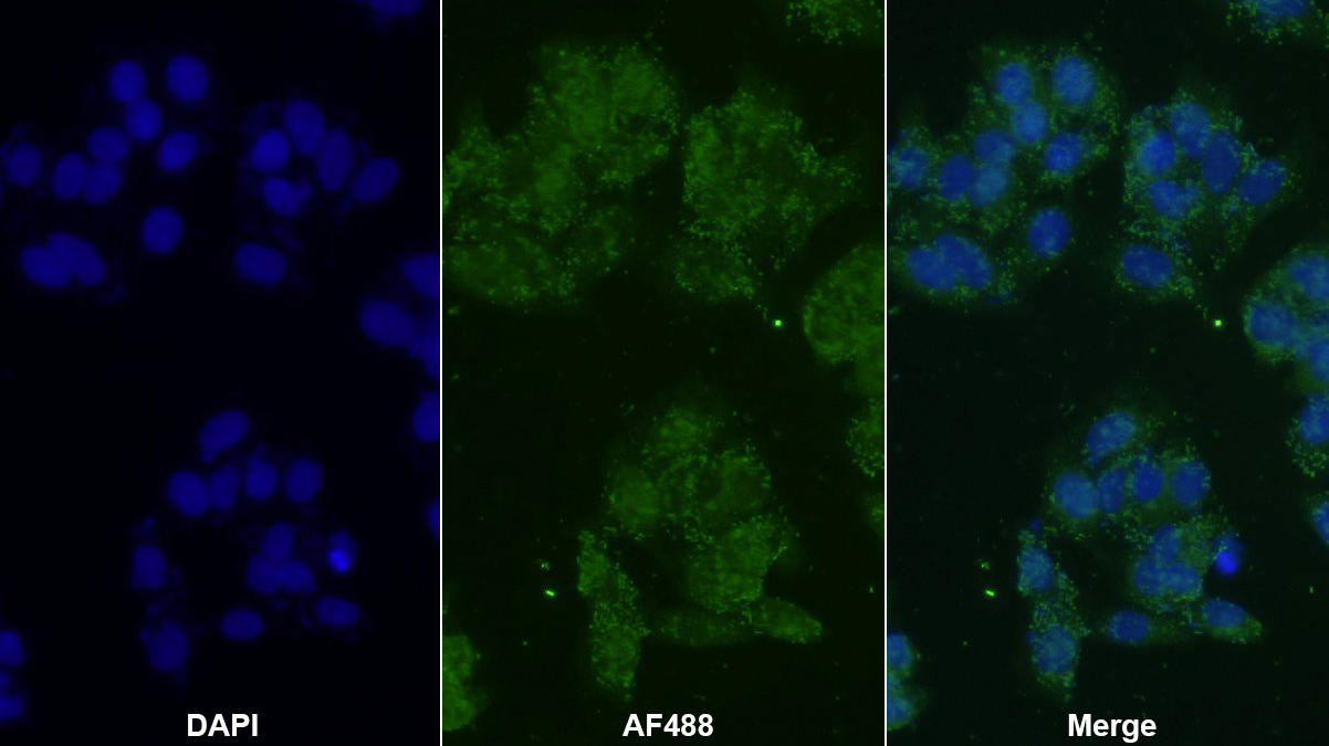 Polyclonal Antibody to Casein Kappa (CSN3)