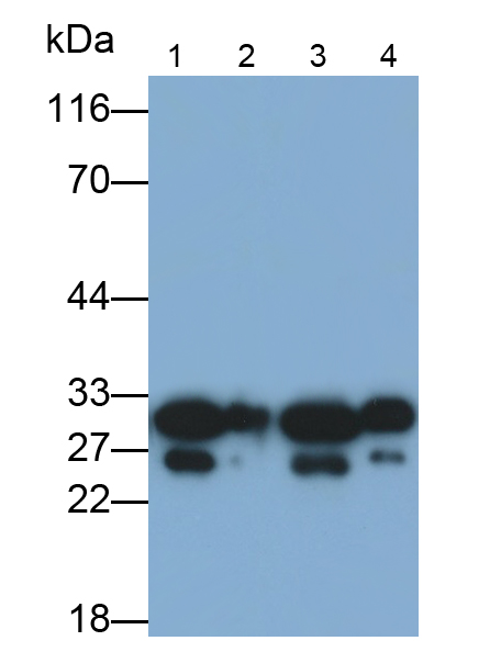 Polyclonal Antibody to Catechol-O-Methyltransferase (COMT)