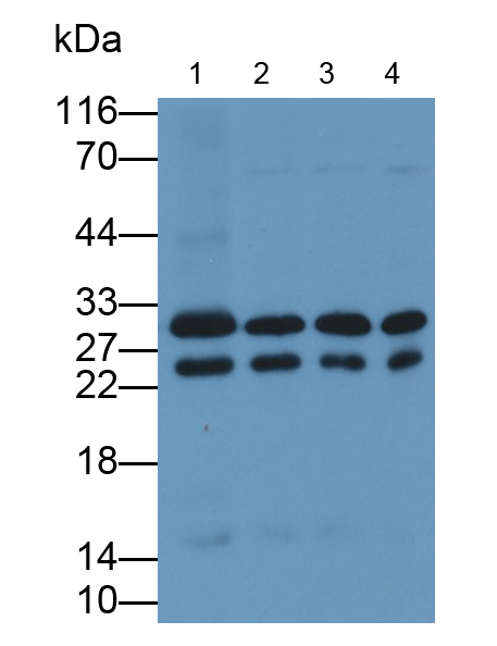 Polyclonal Antibody to Catechol-O-Methyltransferase (COMT)
