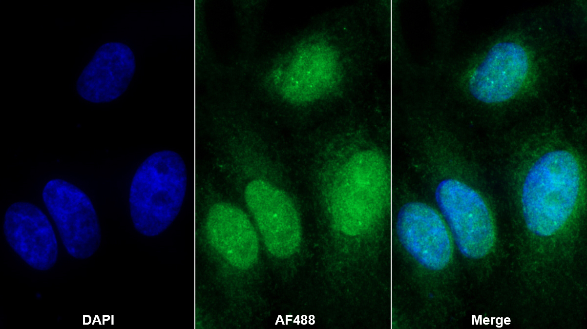 Polyclonal Antibody to LIM Domain Binding Protein 1 (LDB1)