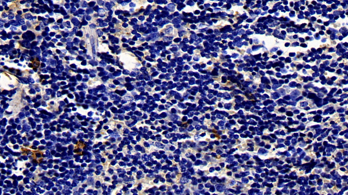 Polyclonal Antibody to Biliverdin Reductase A (BLVRA)