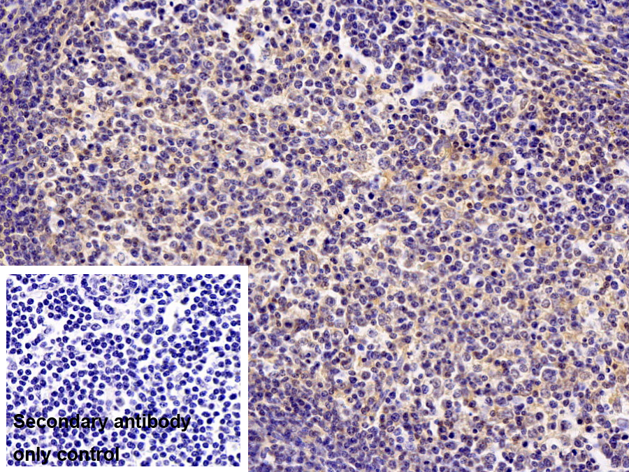 Polyclonal Antibody to Biliverdin Reductase A (BLVRA)
