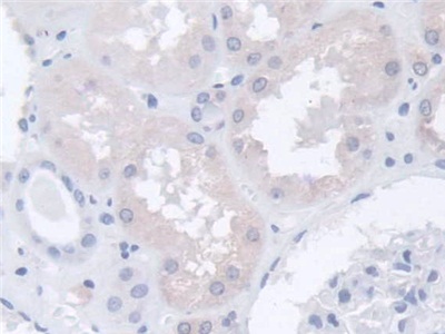 Polyclonal Antibody to Actin Related Protein 2/3 Complex Subunit 2 (ARPC2)