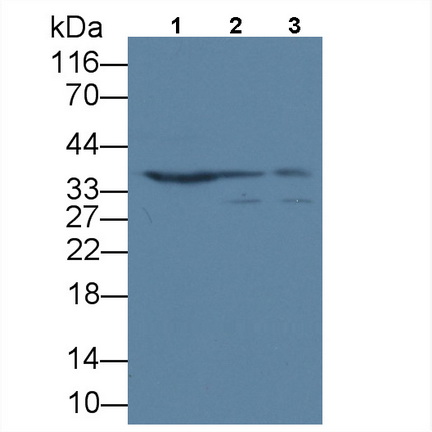Polyclonal Antibody to Acidic Nuclear Phosphoprotein 32 Family, Member A (ANP32A)