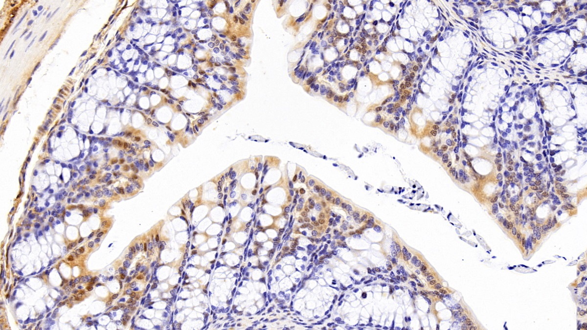 Polyclonal Antibody to Acidic Nuclear Phosphoprotein 32 Family, Member A (ANP32A)