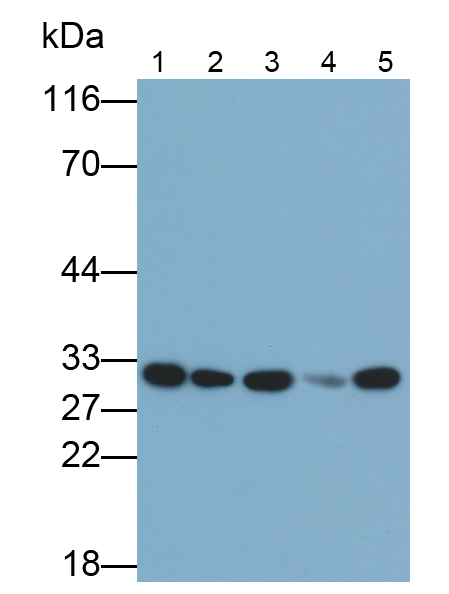 Polyclonal Antibody to Acidic Nuclear Phosphoprotein 32 Family, Member A (ANP32A)