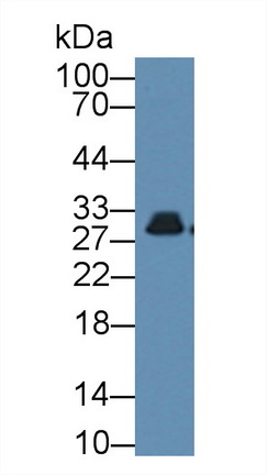 Polyclonal Antibody to Acidic Nuclear Phosphoprotein 32 Family, Member A (ANP32A)