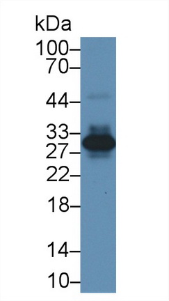 Polyclonal Antibody to Acidic Nuclear Phosphoprotein 32 Family, Member A (ANP32A)