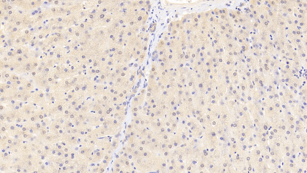 Polyclonal Antibody to Aconitase 1 (ACO1)