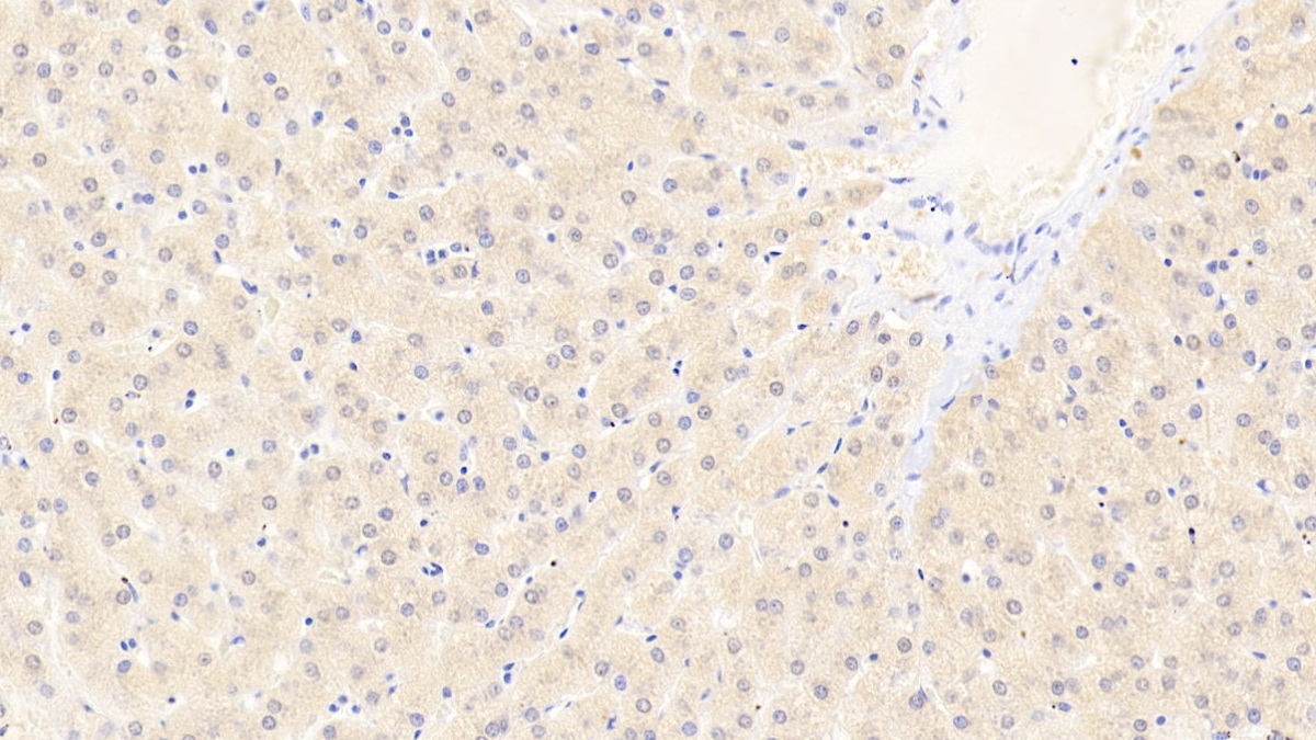 Polyclonal Antibody to Aconitase 1 (ACO1)