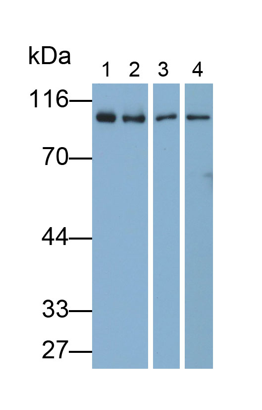 Polyclonal Antibody to Aconitase 1 (ACO1)