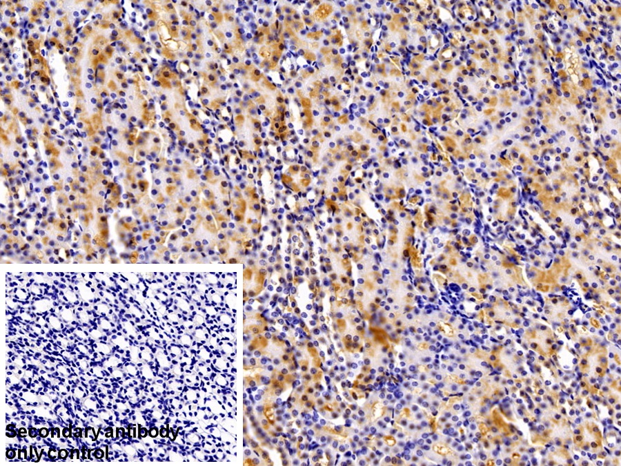 Polyclonal Antibody to Aconitase 1 (ACO1)